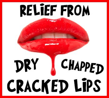 Savannah dentist, Dr. Comer, at Christopher Comer, DMD, tells you how to relieve your dry, chapped, and cracked lips!