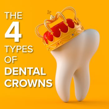 Savannah dentist, Christopher Comer, DMD LLC, guides you through various dental crown types - ceramic, porcelain-fused-to-metal, all-metal, and zirconia