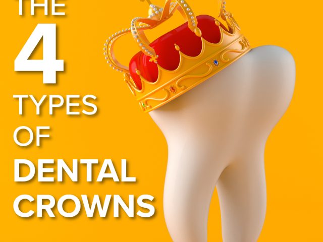 The Four Types Of Dental Crowns (featured image)